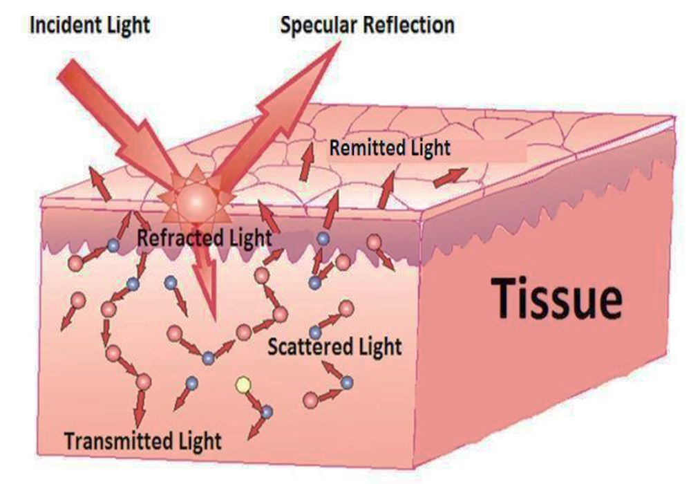 هنگامی که لیزر با پوست برخورد می‌کند، چهار پدیده بازتاب، عبور، پراکندگی و جذب ممکن است رخ دهند
